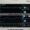 ETCO2 Patient Monitor 6 Parameter 12 inch Thermal Recorder CE ISO certified Manufacturer