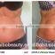 Body Slimming 2016 Cryolipolysis Machine Fat Freeze Slimming/slim Freeze Belt/cool Tech Fat Freezing Machine Reduce Cellulite
