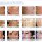 Carboxytherapy Vaginal Tightening CO2 Laser Machine / Warts 40w Removal Fractional CO2 Laser Manufacturer Eliminate Body Odor