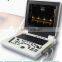 Ce Approved Portable Full Digital Medical Ultrasound Instruments for Hospital use