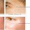 wholsale price for China made best quality radiofrequency face lift RF fractional and microneedle machine guarantee for 2 years