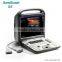 4D Portable color doppler ultrasound price