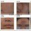Wart Removal Salon Vertical RF Co2 Wrinkle Removal Fractional Laser Skin Treatment Machine Sun Damage Recovery Sun Damage Recovery