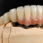 Chinese Dental Lab-Denture Droichead Zirconia - Saotharlann Fiaclóireachta MYY