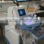cheap ultrasound with trolley