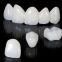 PFM Porcelain Fused To Metal Crown From Outsourcing Dental Lab