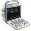 Popular Portable Color Doppler Ultrasound Scanner