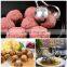 Meat Baller,2 PCS None-Stick Meatball Maker with Detachable Anti-Slip Handles,Stainless Steel Meat Baller Tongs