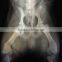 high quality x-ray film