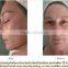 2015 New microcurrent skin tightening machine skin toning therapy