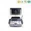MY-A034A 100% quality guarantee Trolley Ultrasound scanner/USG/Medical Ultrasonography