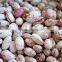 400g canned light speckled kidney beans,Factory wholesale with cheap price