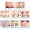Multifunction 6 in 1 deep cleaning skin moisturizing care ultrsonic peeling H2O2 small bubble