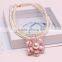 2015 Zhejiang fashion trendy women Necklace Accessories jewelry