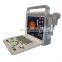 medical ultrasound instrument laptop color doppler portable ultrasound color doppler machine