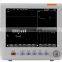 High Quality OEM  Neonates Children Adults Cardiac  Monitor 8 inch vital sign monitor