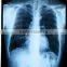 China KND-A/F CE medical dry film disposable medical product
