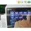 MY-A030E New Arrival Full digital mobile color doppler Ultrasound Diagnostic System machine Price