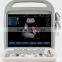 Hand-Carried Color Doppler Diagnostic Ultrasound System BCU30