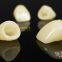Dental crown e.Max ceramic, porcelain crown, dental veneers, laboratoire dentaire, Dentallabor, laboratorio dental, dental laboratory, Shenzhen LJ dental lab China