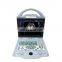 MY-A027A 2D Full digital color doppler system Portable ultrasound machine price