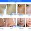 Hot sale electroporation mesotherapy no needle and bipolar rf facial care machine