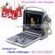 MSLCU28i Cheapest price portable laptop color doppler ultrasound machine 4d image color doppler ultrasound scanner