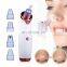 Rechargeable pore vacuum blackhead remover 2020 face deep nose cleaner