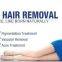 QM-808  808nm diode laser hair removal machine