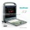 Sonoscape ultrasound Factory price 3D/4D Potable Colorful doppler ultrasound machine Sonoscape S2 for Veterinary