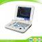 RUS-9000F2 CE Approved hot selling digital handheld ultrasound machine medical equipment-Shelly