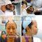 hot sale nd yag laser tattoo removal/best laser tattoo removal/fast effect nd yag tattoo laser