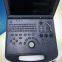 Ultrasound Diagnostic Scanner Laptop Ultrasound Scanner