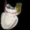 Orthodontic-Appliance  China Dental Laboratory - Outsourcing Dental Lab