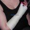 Medical Casting Tapes Fiberglass Cast Bandage CE FDA Polyester Casting Tapes
