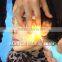 portable q switch nd yag laser / handheld yag laser tattoo removal