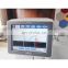 Mindray High quality BC-20 CBC Machine 3-DIFF blood hematology analyzer