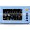 Promotion: AJ-3000Palm New Type Palm Multi-Parameter Patient Monitor