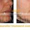 3 in 1 Derma Roller Dermaroller for Treatment of Acne Scars and Healing Wounds