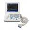 ISO CE approved 10.4 inch SVGA mode HR LCD portable ultrasound scanner