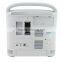 CE ISO FDA approved Chison brand Ultrasound Scanner with 2.5-5.0MHz Convex probe Foot switch Sony UP897 optional
