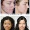 Beauty Gift Device Collagen Lifting Face Cream oxygen jet facial beauty equipment