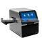 SMT120 Quick Test Result  Blood Testing Equipment  Chemistry Analyzer Biochemistry  Analyzer