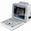 Portable medical black and white ultrasound machine Full digital diagnostic ultrasound