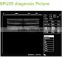 Manufacture Supplies Laptop Ultrasound Scan Machine- BPU09