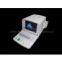 Portable Ultrasound Scanner----CE Approved Ultrasound Machine