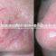 980nm diode laser Vascular Removal / laser diode 980nm / Professional Vascular vein stopper 980nm varicose veins removal diode l