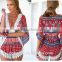 Hot Sale 2015 Summer Women Casual Loose White Lace Floral V-Neck Jumpsuits Rompers Short Plus Size Elegant Jumpsuit S-XL