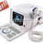 Hot seller Full Digital Portable Ultrasound Scanner RUS-6000D with convex microconvex probe