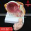 Pregnancy pelvis with mature fetus 2 parts
